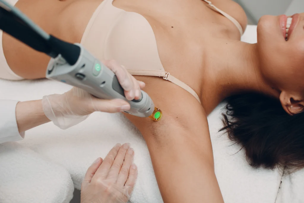 A medical professional performing a laser hair removal treatment on a woman’s underarm using a specialized laser device.